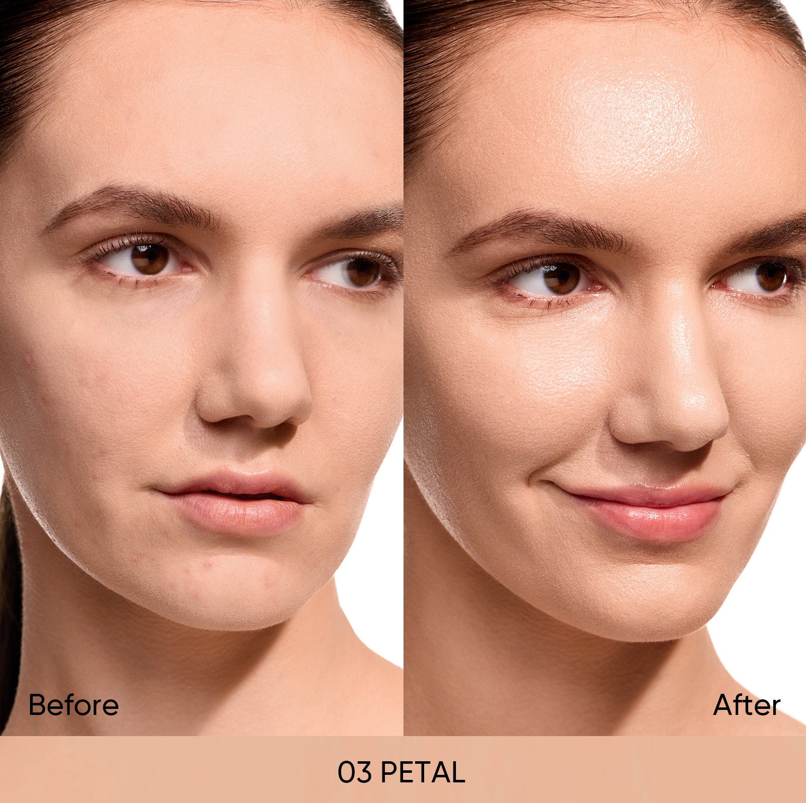 03 PETAL