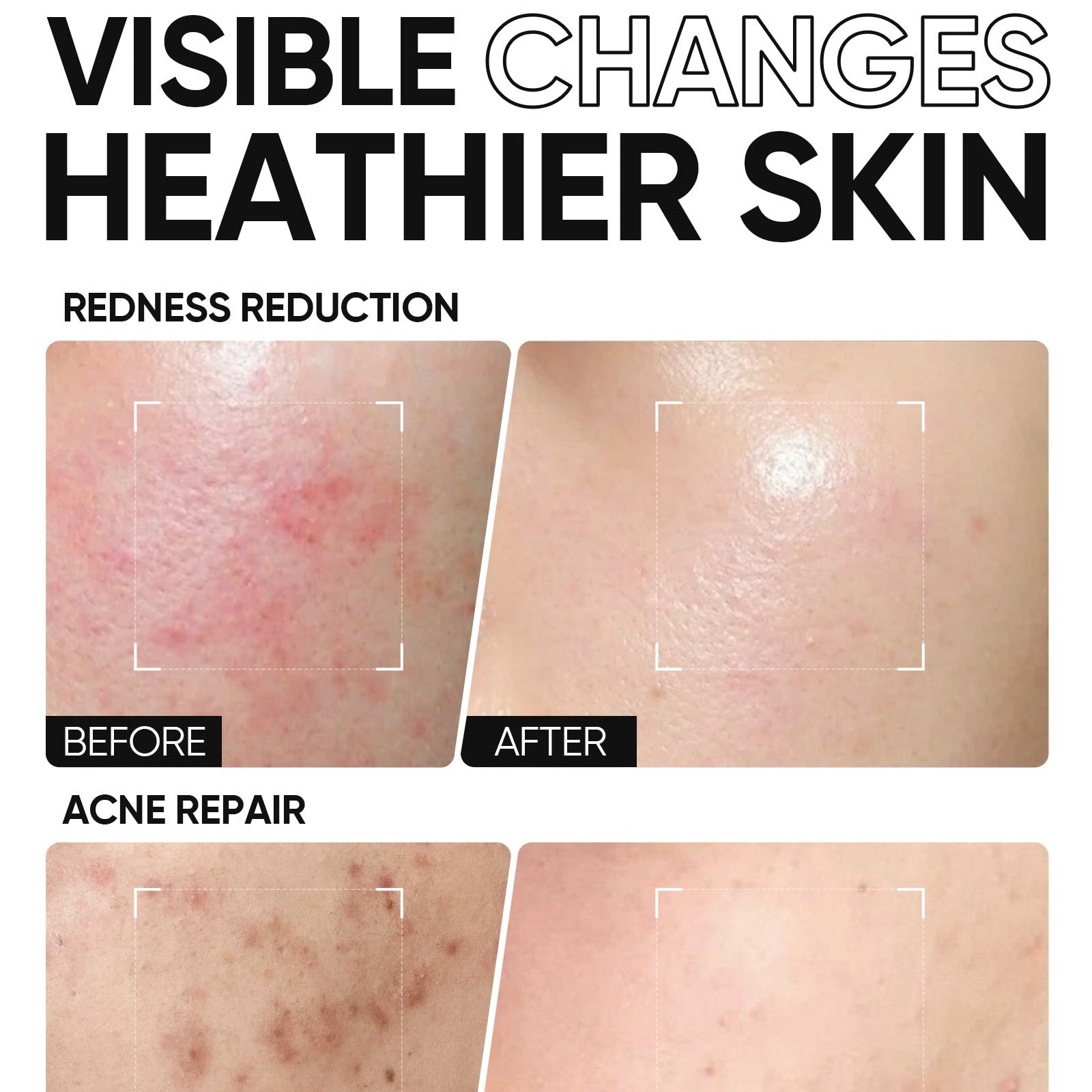 Gel hidratante con barrera de ceramida 5X