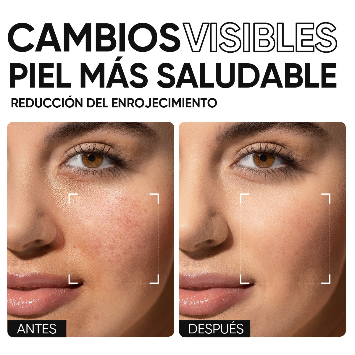 Gel Hidratante Reparador de la Barrera con 5X Ceramidas