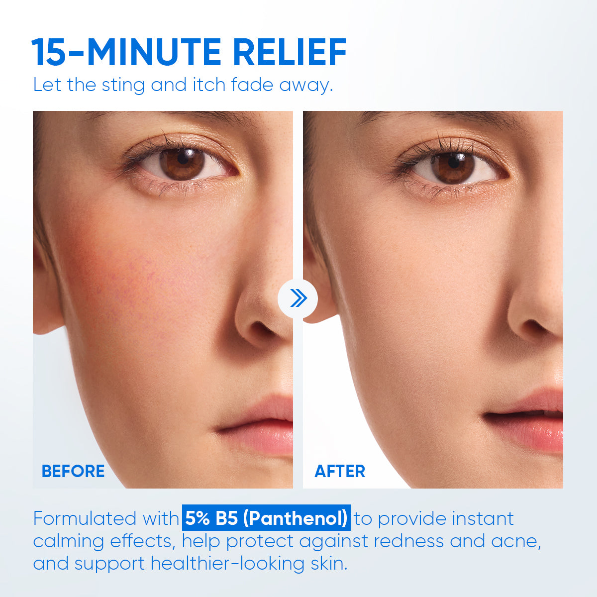 5% B5 Ceramide Barrier Relief Moisturizer