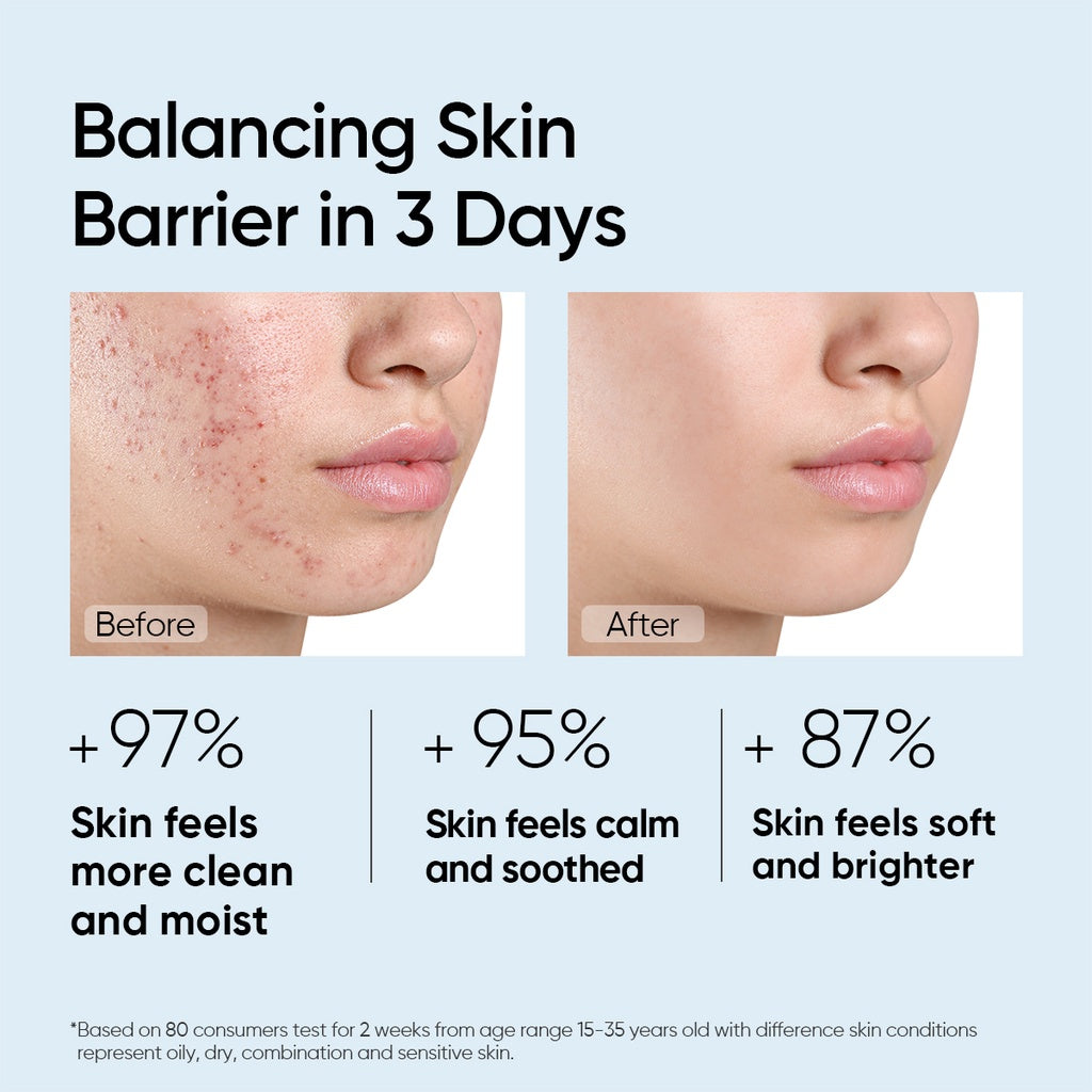 Amino Acid Ultra Gentle Cleansing Mousse