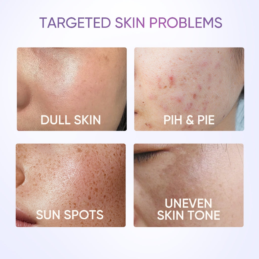 Symwhite377 Gel hidratante para manchas oscuras