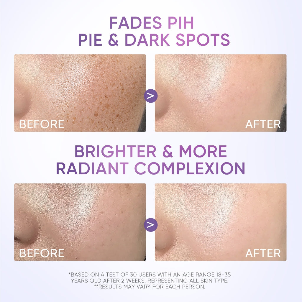 Symwhite377 Gel hidratante para manchas oscuras