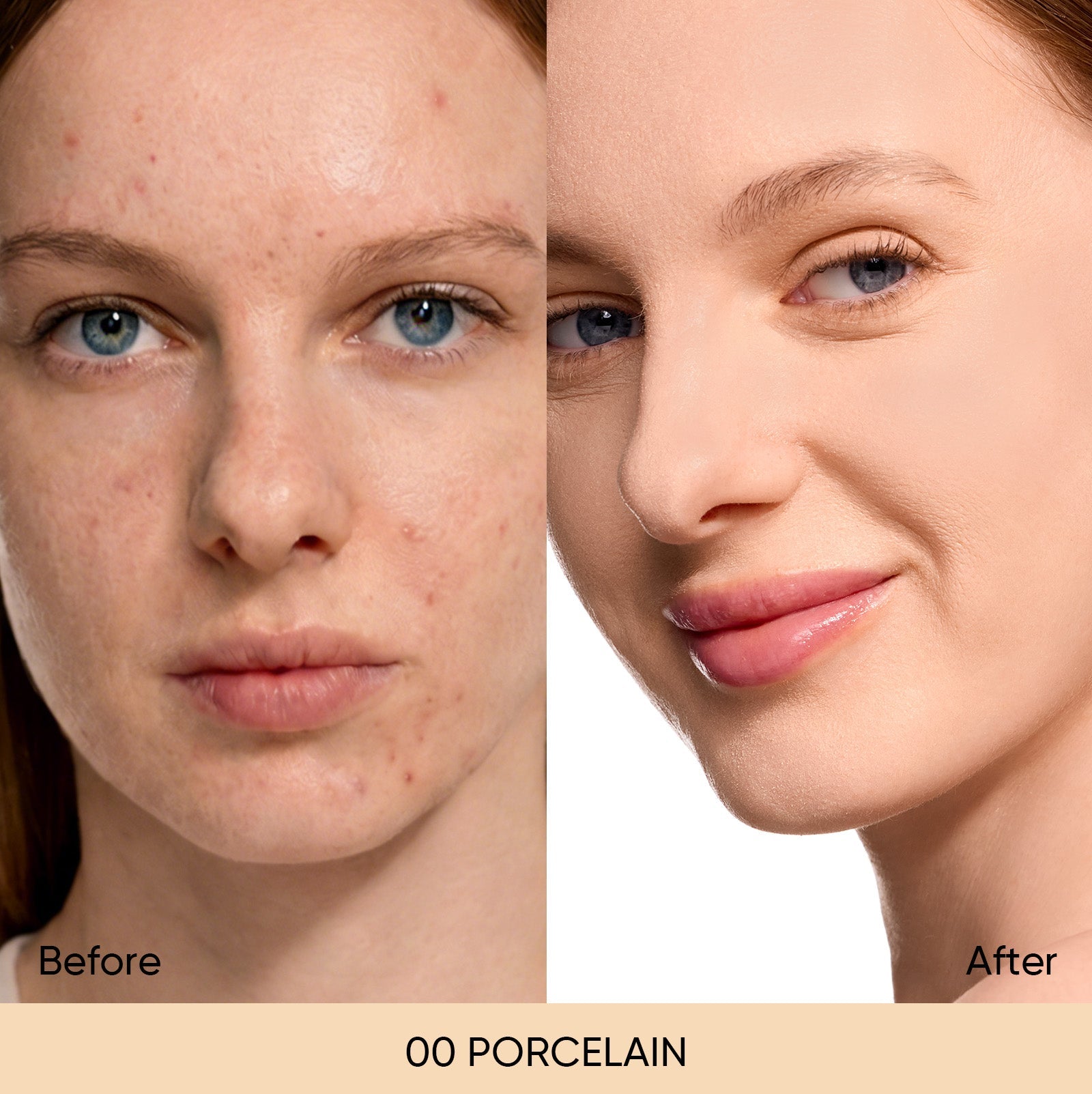 00 PORCELAIN