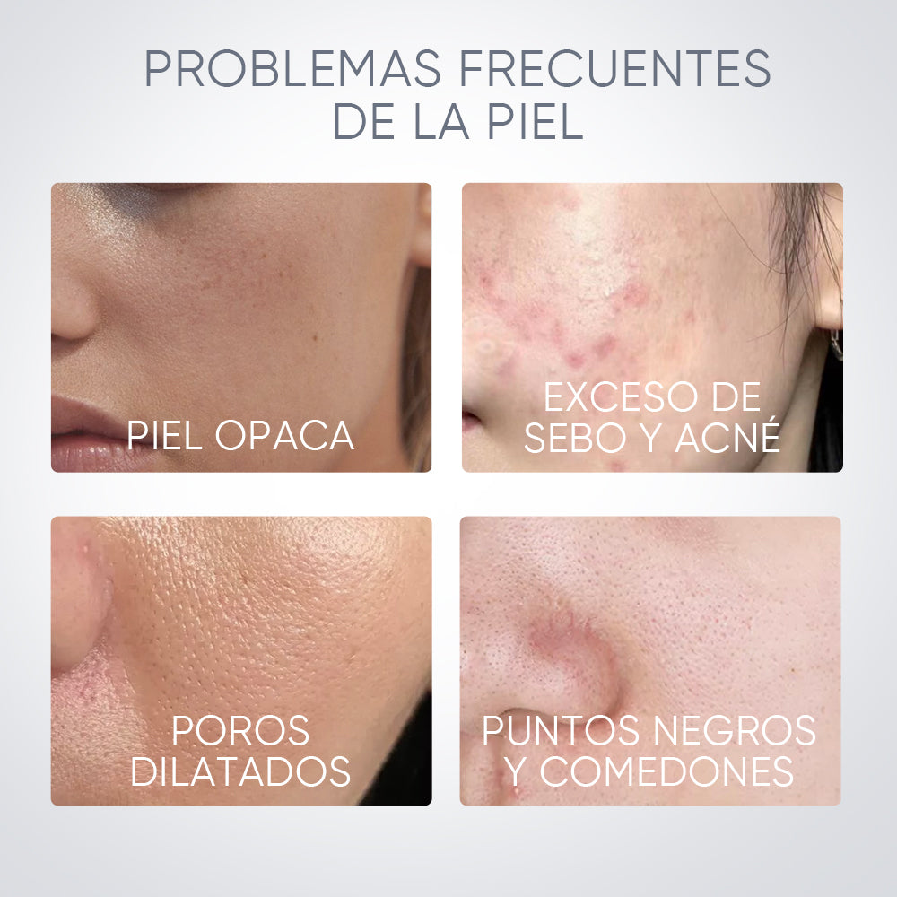 Mascarilla en Barra de Arcilla Volcánica de Alaska Limpiadora de Puntos Negros