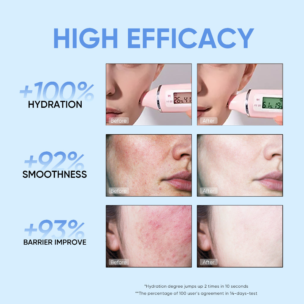 4D Hyaluronic Acid Barrier Essence Toner
