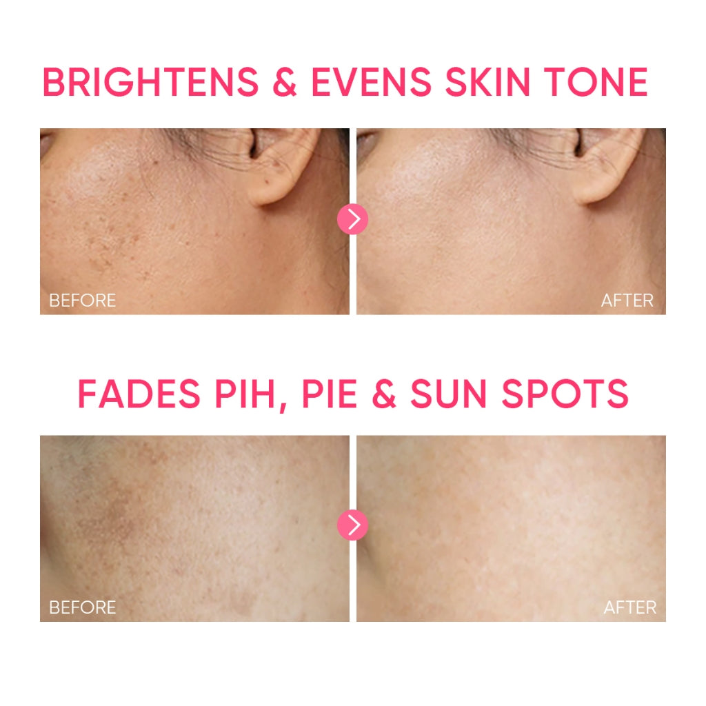 MSH Niacinamide Brightening Moisture Gel